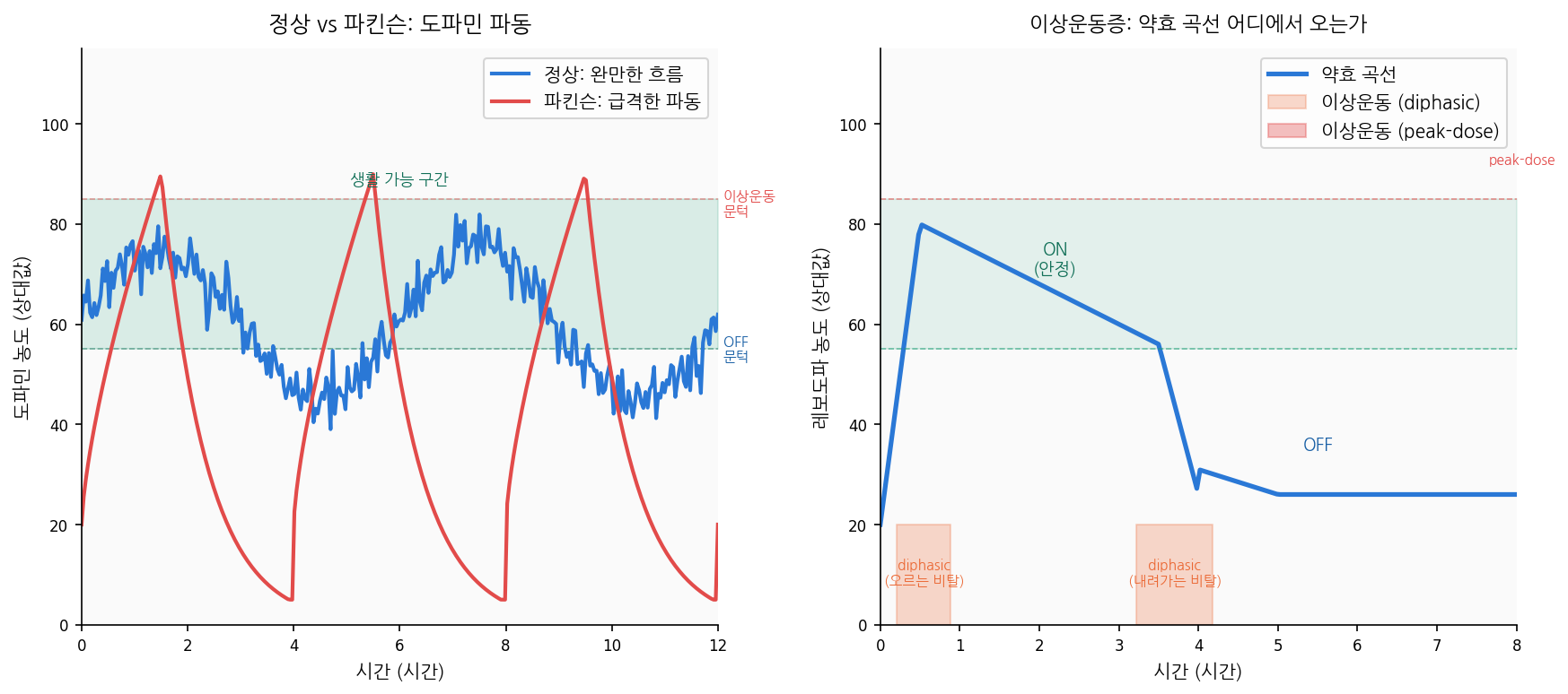 정상 vs 파킨슨 도파민 파동 비교, 그리고 이상운동증 발생 위치