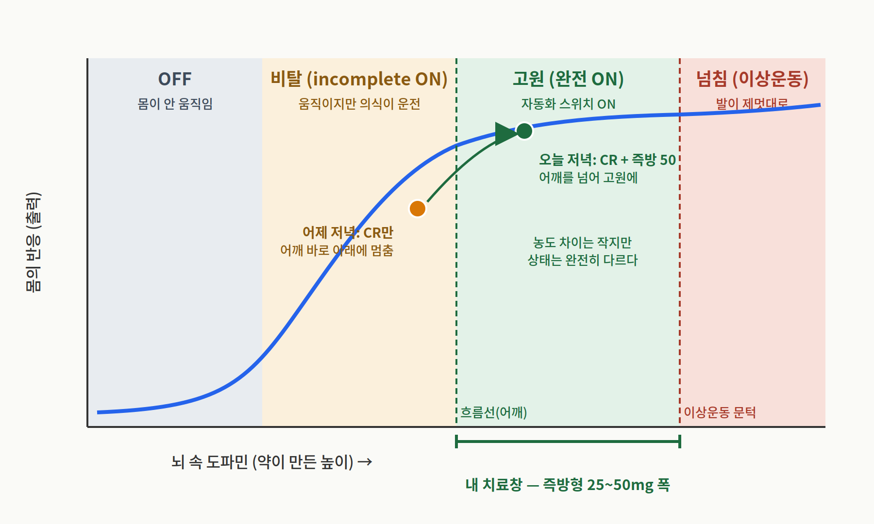OFF, 불완전 ON, 완전 ON, 이상운동증 구간을 S자 반응곡선으로 나타낸 개념도